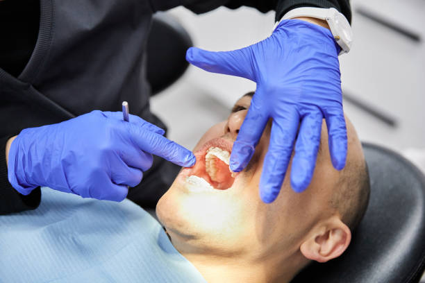 Best Emergency Dentist for Lost Fillings or Crowns in Jennings Lodge, OR